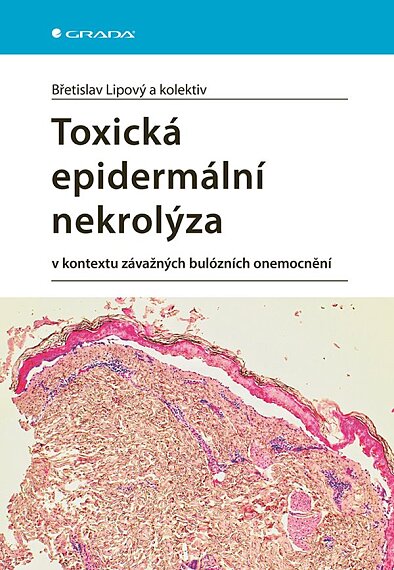 Toxická epudermální nekrolýza
