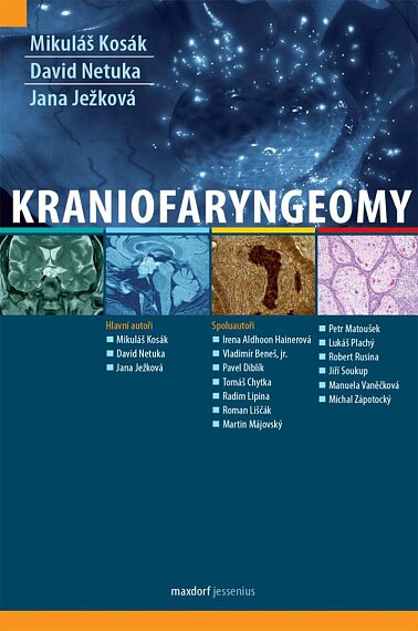 Kraniofaryngeony