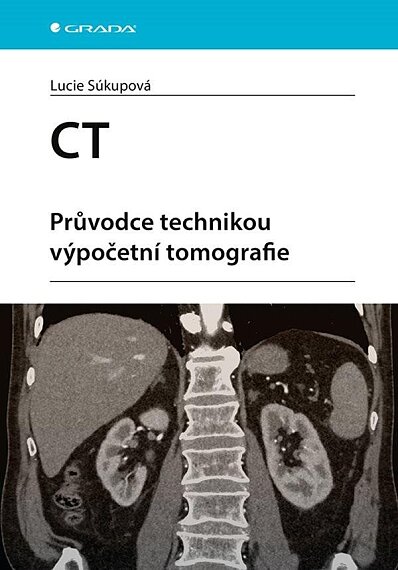 CT - průvodce technikou vypočetní tomografie