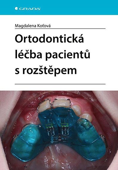 Ortodontická léčba pecientů s rozštěpem