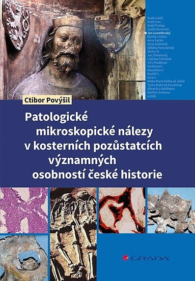 Patologické mikrospické nálezy v kosterních pozůstatcích významných osobností české historie
